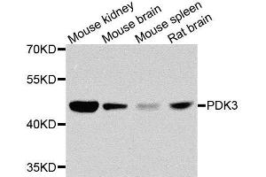 Western blot analysis of extracts of various cell lines, using PDK3 antibody. (PDK3 抗体  (AA 137-406))