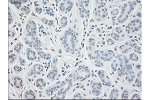 Immunohistochemical staining of paraffin-embedded breast tissue using anti-GAD1 mouse monoclonal antibody.