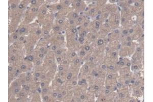 DAB staining on IHC-P; Samples: Human Liver Tissue (ALDH3A1 抗体  (AA 1-311))