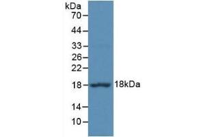 Western Blotting (WB) image for anti-Eukaryotic Translation Initiation Factor 4E Binding Protein 1 (EIF4EBP1) (AA 2-117) antibody (ABIN7436867)