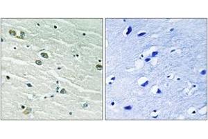 Immunohistochemistry analysis of paraffin-embedded human brain tissue, using MER/SKY (Ab-749/681) Antibody. (MER/SKY (AA 716-765) 抗体)