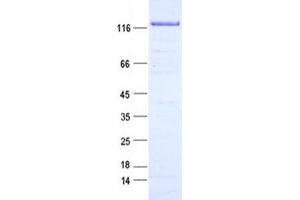 Western Blotting (WB) image for RNA Binding Motif Protein 10 (RBM10) protein (DYKDDDDK Tag) (ABIN2730603)