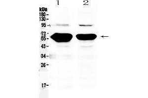 Western blot analysis of Alpha Amylase 1 using anti- Alpha Amylase 1 antibody . (AMY1A, AMY1B, AMY1C (AA 20-50), (N-Term) 抗体)