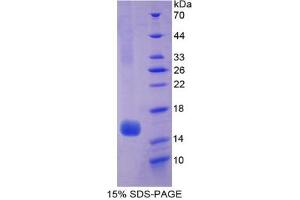 SDS-PAGE analysis of Human Hexosaminidase B beta Protein. (HEXB 蛋白)