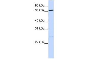 WB Suggested Anti-TLK1 Antibody Titration: 0. (TLK1 抗体  (N-Term))