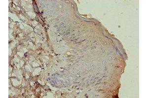 Immunohistochemistry of paraffin-embedded human skin tissue using ABIN7164023 at dilution of 1:100 (ATP12A 抗体  (AA 171-306))