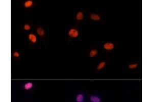 Immunofluorescence analysis of NIH-3T3 cells using PSME3 Polyclonal Antibody at dilution of 1:100 (40x lens). (PSME3 抗体)