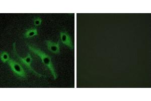 Peptide - +Immunofluorescence analysis of HeLa cells, using HER2 antibody. (ErbB2/Her2 抗体)