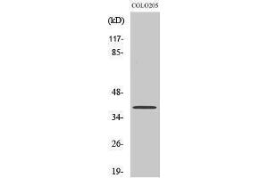 Western Blotting (WB) image for anti-X-Ray Repair Complementing Defective Repair in Chinese Hamster Cells 4 (XRCC4) (C-Term) antibody (ABIN3177959) (XRCC4 抗体  (C-Term))