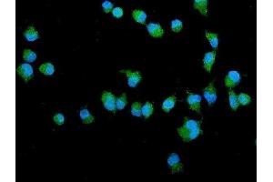 IF analysis of Filamin A/FLNA using anti-Filamin A/FLNA antibody (ABIN7601782).