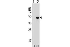 Western Blotting (WB) image for anti-Jumonji Domain Containing 5 (JMJD5) antibody (ABIN2995955) (JMJD5 抗体)