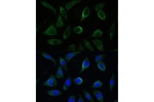 Immunofluorescence analysis of L929 cells using GK2 antibody (ABIN7267458) at dilution of 1:100. (GK2 抗体  (AA 1-150))