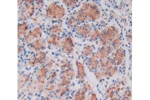 IHC-P analysis of stomach tissue, with DAB staining. (LOXL4 抗体  (AA 479-756))
