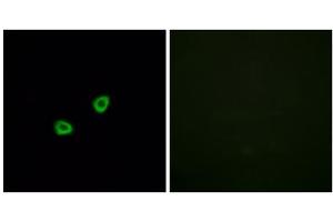 Immunofluorescence analysis of HUVEC cells, using OR1L6 antibody. (OR1L6 抗体  (Internal Region))