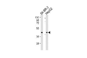 All lanes : Anti-ACAT1 Antibody (C-term) at 1:1000 dilution Lane 1: SK-BR-3 whole cell lysates Lane 2: HepG2 whole cell lysates Lysates/proteins at 20 μg per lane. (ACAT1 抗体  (C-Term))