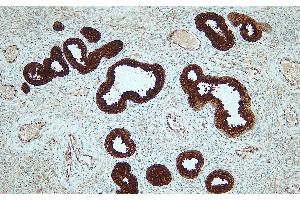 Immunohistochemistry (IHC) image for anti-Prostate Specific Antigen (PSA) (N-Term) antibody (ABIN7598882) (Prostate Specific Antigen 抗体  (N-Term))