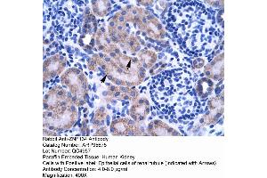 Human kidney (ZNF134 抗体  (Middle Region))