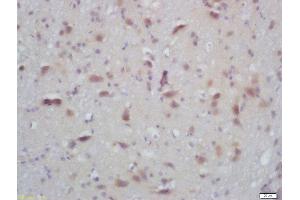 Formalin-fixed and paraffin embedded mouse brain labeled with Rabbit Anti-PKC alpha/beta II (Thr638/641) Polyclonal Antibody, Unconjugated  at 1:200 followed by conjugation to the secondary antibody and DAB staining (PRKCA beta 2 抗体  (pThr638, pThr641))