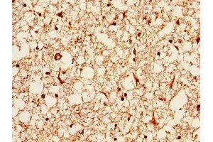 IHC image of ABIN7144427 diluted at 1:1000 and staining in paraffin-embedded human brain tissue performed on a Leica BondTM system. (APOE 抗体  (AA 21-110))