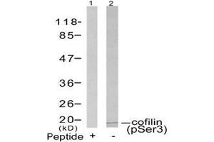 Image no. 3 for anti-Cofilin 1 (CFL1) (pSer3) antibody (ABIN196854) (Cofilin 抗体  (pSer3))