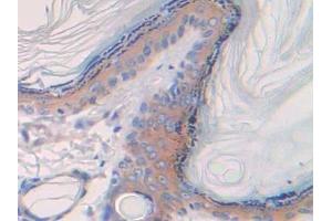 Immunohistochemistry (IHC) image for anti-Spectrin alpha Chain, Brain (SPTAN1) (AA 2071-2269) antibody (ABIN7438451)