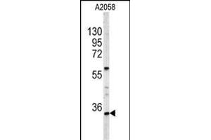 Western blot analysis of HOXA9 Antibody (C-term) (ABIN653066 and ABIN2842667) in  cell line lysates (35 μg/lane). (HOXA9 抗体  (C-Term))