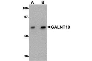 Western blot analysis of GALNT10 in SK-N-SH cell lysate with AP30351PU-N GALNT10 antibody at (A) 1 and (B) 2 μg/ml. (GALNT10 抗体  (C-Term))