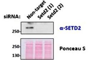 SETD2 polyclonal antibody  (0. (SETD2 抗体  (Internal Region))