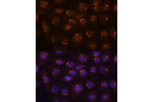 Immunofluorescence analysis of C6 cells using B3GNT4 antibody (ABIN7265875) at dilution of 1:100. (B3GNT4 抗体  (AA 165-305))