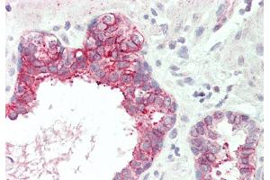 Immunohistochemistry (IHC) image for anti-Solute Carrier Family 39 (Metal Ion Transporter), Member 5 (SLC39A5) (N-Term) antibody (ABIN2781736)
