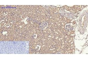 Immunohistochemistry of paraffin-embedded Rat kidney tissue using GLUT-4 Polyclonal Antibody at dilution of 1:200. (GLUT4 抗体)