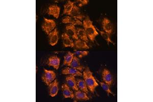 Immunofluorescence analysis of C6 cells using CRELD1 antibody (ABIN7266621) at dilution of 1:100. (CRELD1 抗体  (AA 50-150))