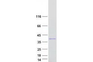 PRDM2 Protein (Transcript Variant 4) (Myc-DYKDDDDK Tag)