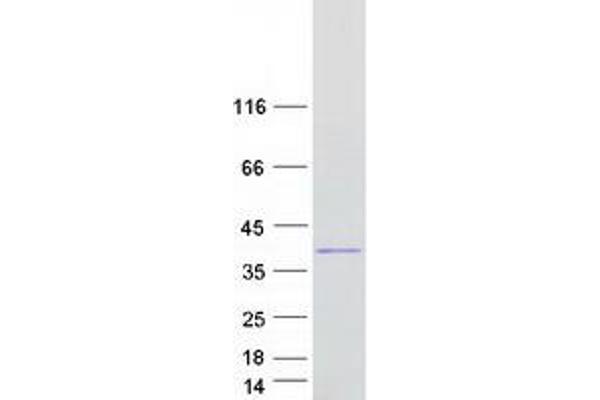 PRDM2 Protein (Transcript Variant 4) (Myc-DYKDDDDK Tag)