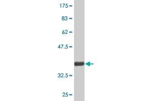 Western Blotting (WB) image for anti-Cytochrome P450, Family 2, Subfamily A, Polypeptide 6 (CYP2A6) (AA 395-494) antibody (ABIN514824)