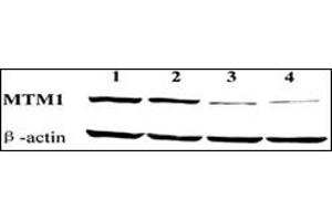 Western blot showing knockdown of endogenous MTM1 expression by MTM1-targeting vectors pD and pD. (MTM1 抗体  (C-Term))