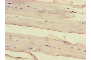 Immunohistochemistry of paraffin-embedded human skeletal muscle tissue using ABIN7160855 at dilution of 1:100