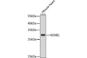 Western blot analysis of extracts of mouse heart, using HOXB1 antibody (ABIN6128032, ABIN6141942, ABIN6141943 and ABIN6222309) at 1:1000 dilution. (HOXB1 抗体  (AA 35-180))