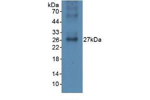 WB of Protein Standard: different control antibodies against Highly purified E. (CRP ELISA 试剂盒)