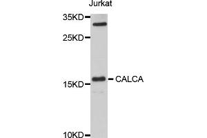Western blot analysis of extracts of Jurkat cells, using CALCA antibody (ABIN1876765) at 1:1000 dilution. (CGRP 抗体)
