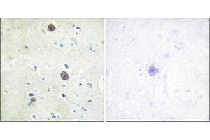 Immunohistochemical analysis of paraffin-embedded human brain tissue using Amyloid β A4 (phospho-Thr743/668) antibody (left)or the same antibody preincubated with blocking peptide (right). (APP 抗体  (pThr743))