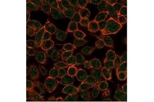 Immunofluorescence analysis of PFA-fixed HeLa cells. (TDRKH 抗体)