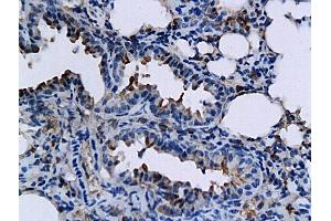 Formalin-fixed and paraffin embedded mouse lung labeled with Anti-TNFSF15/TL1A Polyclonal Antibody, Unconjugated (ABIN709556) followed by conjugation to the secondary antibody and DAB staining (TNFSF15 抗体  (AA 161-251))