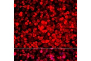 Immunofluorescence analysis of HeLa cells using PUF60 Polyclonal Antibody (PUF60 抗体)