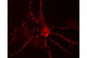 Immunocytochemistry on cultured hippocampus neurons (dilution 1 : 300). (Bassoon 抗体  (C-Term))