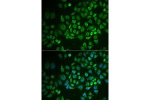 Immunofluorescence analysis of A549 cell using GPLD1 antibody. (GPLD1 抗体)