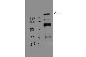 Western Blot (WB) analysis of JK using BRCA1 Polyclonal Antibody diluted at 1:1000. (BRCA1 抗体  (Ser184))