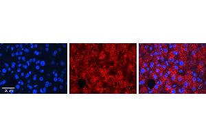 Immunohistochemistry (IHC) image for anti-Ras Homolog Family Member D (RHOD) (N-Term) antibody (ABIN2775403) (RHOD 抗体  (N-Term))