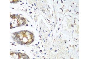 Immunohistochemistry of paraffin-embedded Human colon using FLT4 Polyclonal Antibody at dilution of 1:200 (40x lens). (FLT4 抗体)