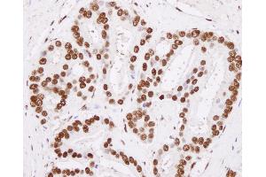 anti-Heterogeneous Nuclear Ribonucleoprotein H1 (H) (HNRNPH1) (C-Term) antibody